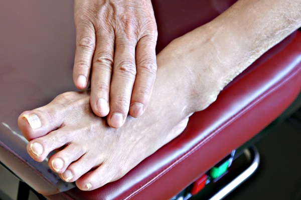 Foot Arthritis Treatment Alberta